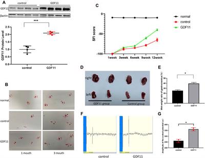 The GDF11 Promotes Nerve Regeneration After Sciatic Nerve Injury in Adult Rats by Promoting Axon Growth and Inhibiting Neuronal Apoptosis